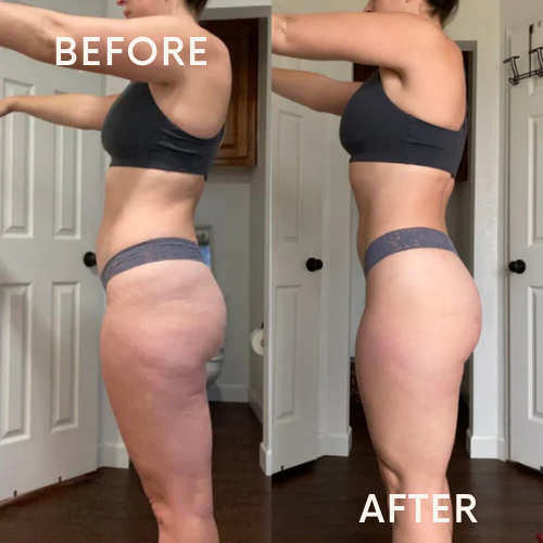 Glowea Sculptroll™ | Cellulite Roller